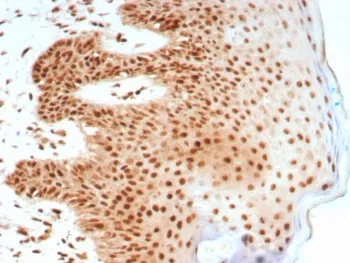 Nucleolin Recombinant Antibody - image 1