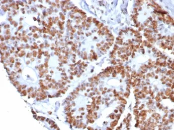 Nucleolin Recombinant Antibody - image 1