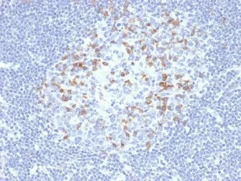 PDCD1 Recombinant Antibody / PD-1 / PD1 - image 1