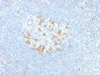 PDCD1 Recombinant Antibody / PD-1 / PD1 - image 1