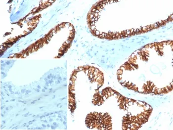 CTNNB1 Recombinant Antibody / Beta Catenin - image 1