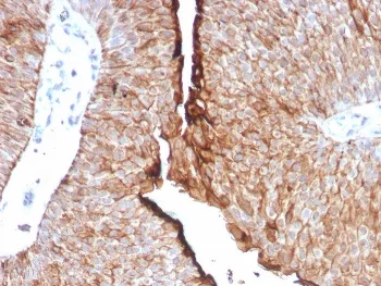 Uroplakin 1B Recombinant Antibody / UPK1B - image 1