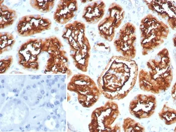 CD10 Recombinant Antibody / Neprilysin - image 1