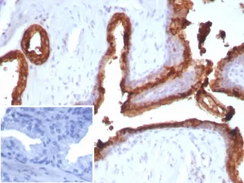 PSAP Antibody / Prostate Specific Acid Phosphatase - image 1