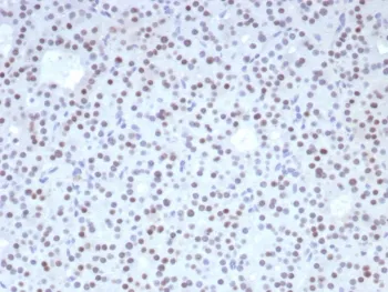 FOXL2 Recombinant Antibody - image 1