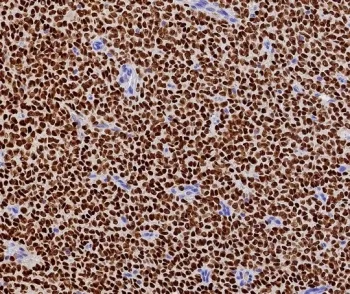 FOXL2 Recombinant Antibody - image 1