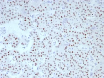 FOXL2 Recombinant Antibody - image 1