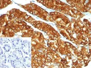 Claudin18.2 Recombinant Antibody - image 1