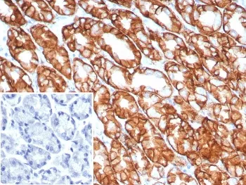 Claudin18.2 Recombinant Antibody - image 1