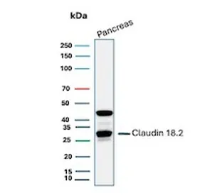 Claudin18.2 Recombinant Antibody - image 1