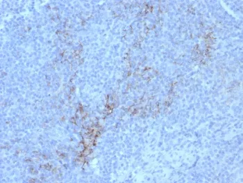 CD10 Recombinant Antibody / Neprilysin - image 1
