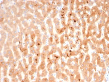 Bradykinin Antibody / Kininogen - image 1