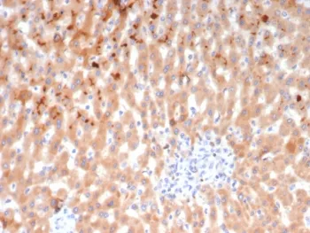 Bradykinin Antibody / Kininogen - image 1