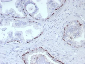 p63 Recombinant Antibody / Tumor protein 63 - image 1
