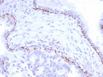 p40 / deltaNp63 Recombinant Antibody - image 1