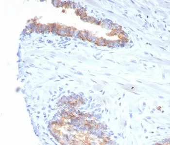 CD38 Recombinant Antibody - image 1