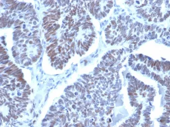 LDB2 Antibody / LIM domain binding 2 - image 1