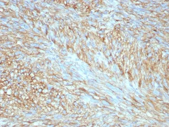 c-Kit Recombinant Antibody / CD117 / SCFR - image 1