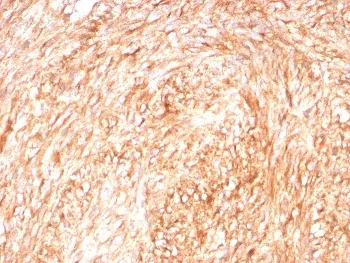 c-Kit Recombinant Antibody / CD117 / SCFR - image 1