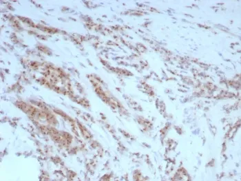 Osteopontin Recombinant Antibody / OPN / SPP1 - image 1
