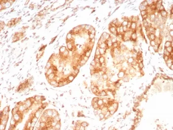 Osteopontin Recombinant Antibody / OPN / SPP1 - image 1