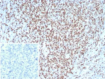 LEF1 Recombinant Antibody / Lymphoid enhancer-binding factor 1 / TCF1 alpha - image 1