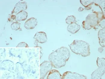 FGF2 Antibody / Fibroblast growth factor 2 - image 1