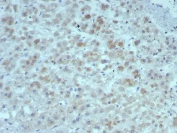 IL15 Recombinant Antibody - image 1