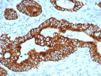 AMACR / p504S Antibody (Prostate Cancer Marker) - image 1