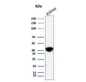 AMACR / p504S Recombinant Antibody (Prostate Cancer Marker) - image 1