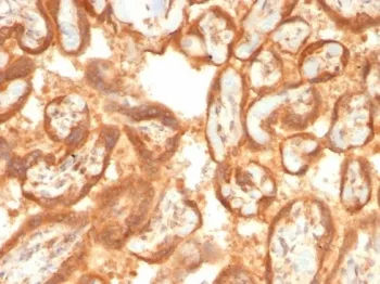 VEGF Recombinant Antibody / Vascular Endothelial Growth Factor - image 1