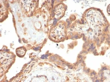 VEGF Recombinant Antibody / Vascular Endothelial Growth Factor - image 1