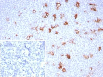 SPARC Recombinant Antibody / Osteonectin - image 1