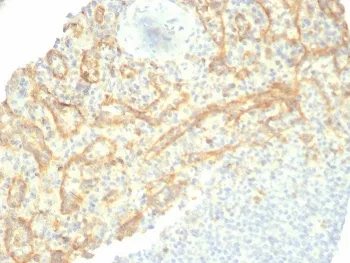 TIM-3 Recombinant Antibody / HAVCR2 - image 1