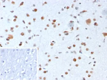 Nucleophosmin Recombinant Antibody / NPM1 - image 1