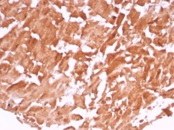 VEGF Recombinant Antibody / Vascular Endothelial Growth Factor - image 1