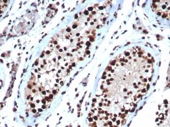 HSP70 Antibody / HSPA1B - image 1