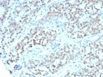 BTBD9 Antibody / BTB/POZ domain-containing protein 9 - image 1