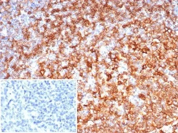 HLA-DRB Recombinant Antibody - image 1