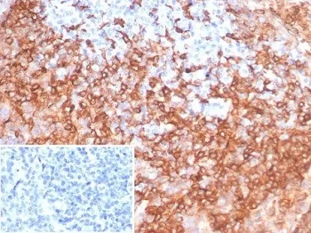 HLA-DRB Recombinant Antibody - image 1
