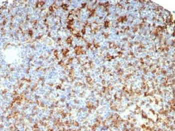 HLA-DRB Recombinant Antibody - image 1