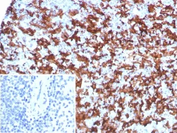 IBA1 Recombinant Antibody / AIF-1 - image 1