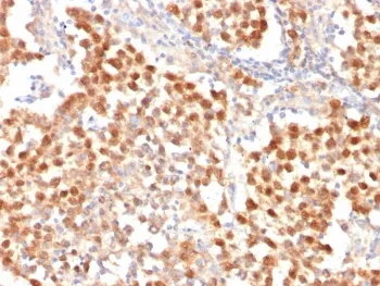 Oct4 Recombinant Antibody / POU5F1 - image 1