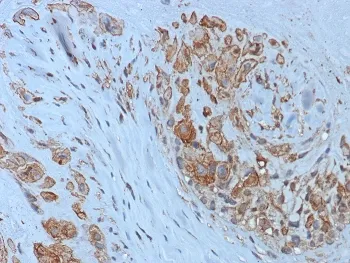 HLA-G Recombinant Antibody - image 1