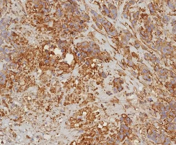 HLA-G Recombinant Antibody - image 1