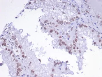 AP2 alpha Antibody / TFAP2A / Activator protein 2 - image 1