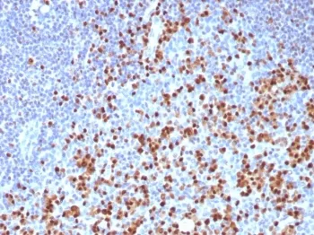 IRF4 Recombinant Antibody / Interferon regulatory factor 4 / MUM-1 - image 1