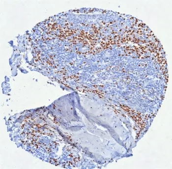 IRF4 Recombinant Antibody / Interferon regulatory factor 4 / MUM-1 - image 1