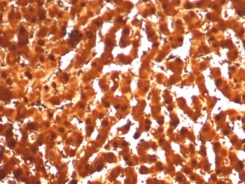 ARG1 Recombinant Antibody / Arginase 1 - image 1