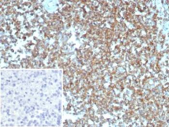 Beta Actin Antibody / ACTB - image 1